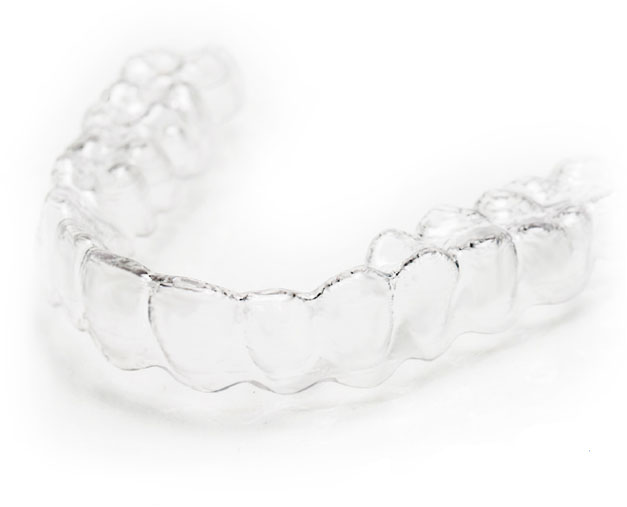 kieferorthopaedie-duesseldorf-durchsichtige-zahnschiene.jpg.pagespeed.ic.cMJCwo7qIr